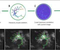 Hieroglyph: Hierarchical Glia Graph Skeletonization and Matching