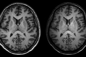 brain scans.